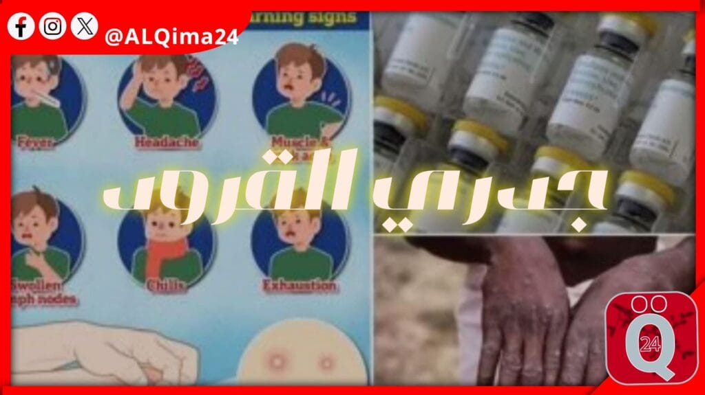 إجراءات الوقاية من مرض جدري القرود: نصائح وزارة الصحة والسكان